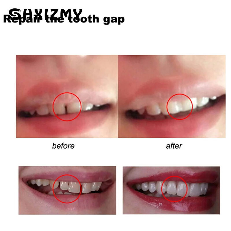 10g/50g/100g Temporary Tooth Repair Teeth And Gap Falseteeth Solid Glue Denture Adhesive Tool