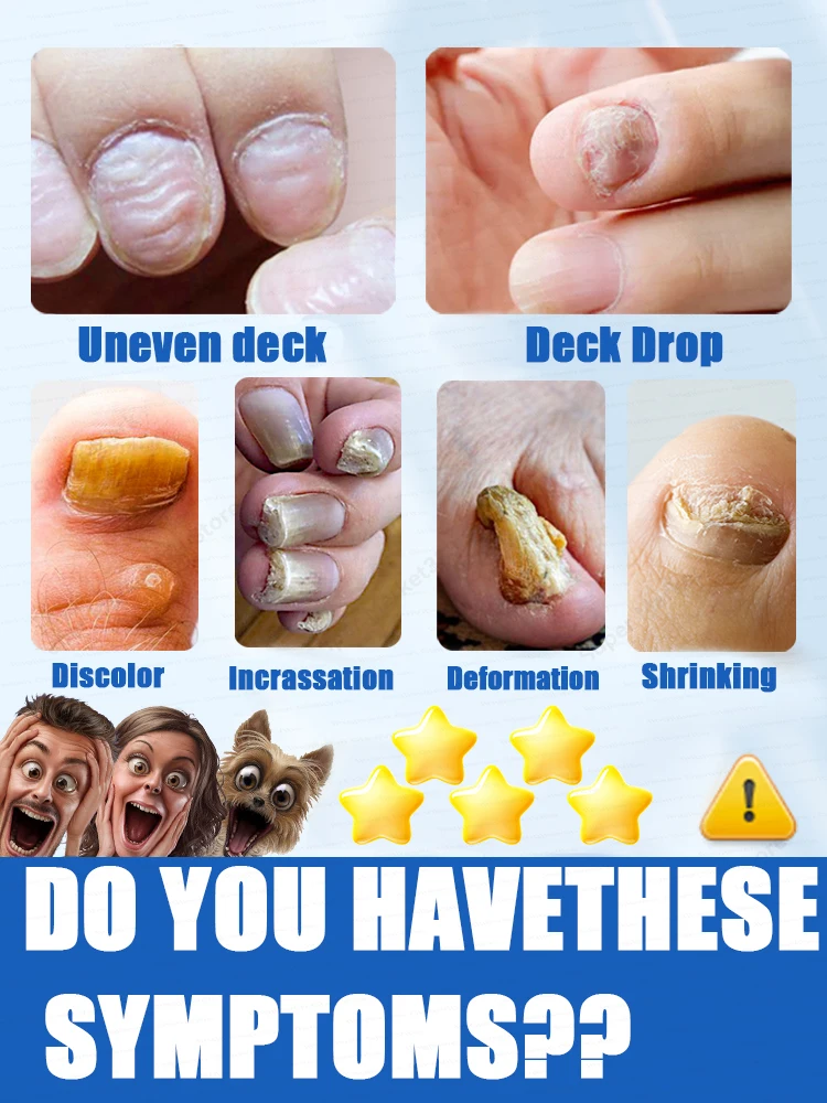 Have healthy nails