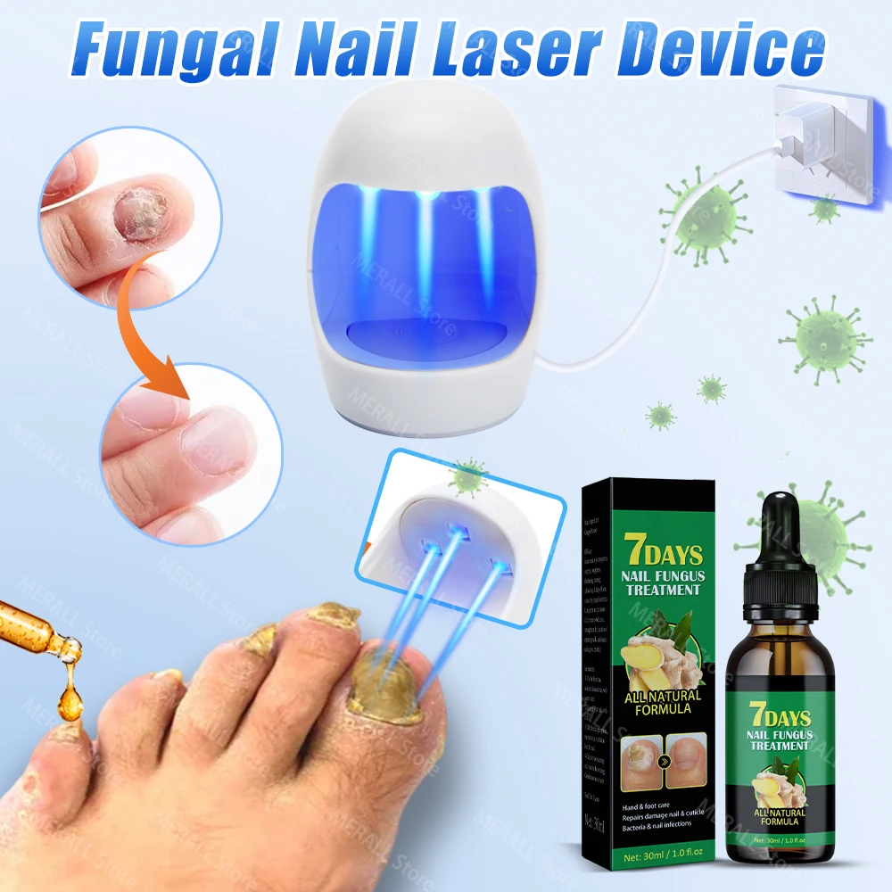 Nail Fungus Laser Device Nail Fungal Treatment Essential Oil Repair Toenail Fingernail Anti Infection Onychomycosis Cure Ingrown