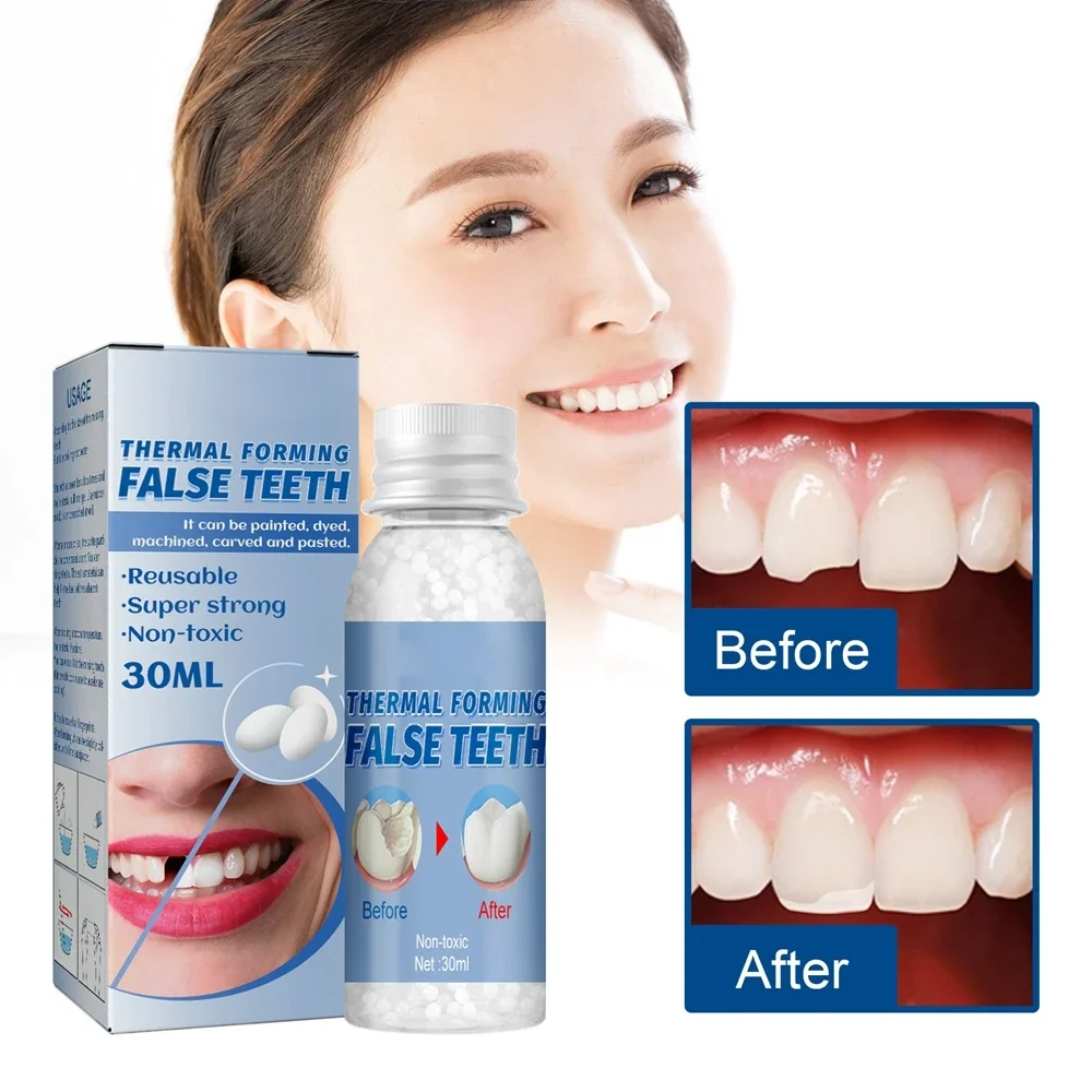 Resin Tooth Repair Glue Shapeable Teeth Fill Gaps Solid Glue Temporary Teeth Repair Falseteeth Glue Dental Beauty Health