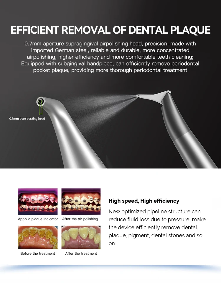 AZDENT Dental Air Polisher Dental Subgingival Handstück Griff Düsen Werkzeug Passend für EMS Air-Flow Ultraschall-Periodontal-Scaler – Detail 8