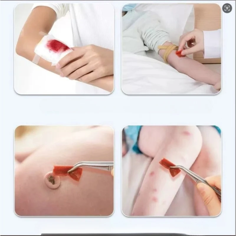 مناديل مبللة مطهرة باليود أو مستلزمات الإسعافات الأولية أو لتنظيف وتطهير الجروح والكشط عند السفر #2