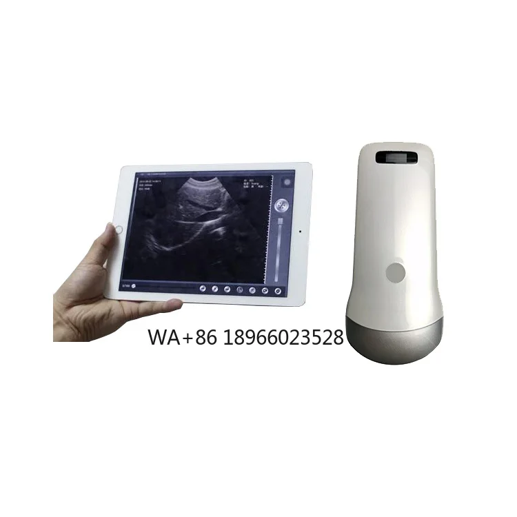 

Android/ios System Available Wireless Ultrasound Probe Scanner Wireless Usg