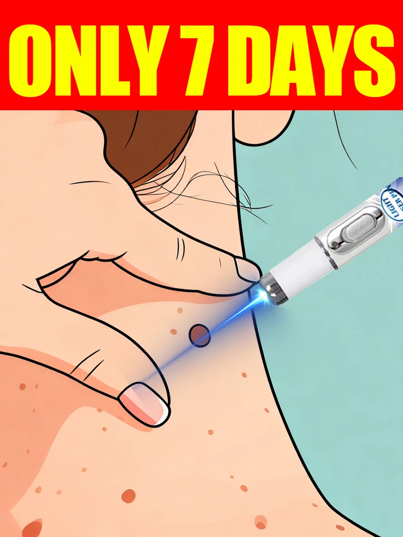 

blue light pen solve warts, hot sale wart care tools