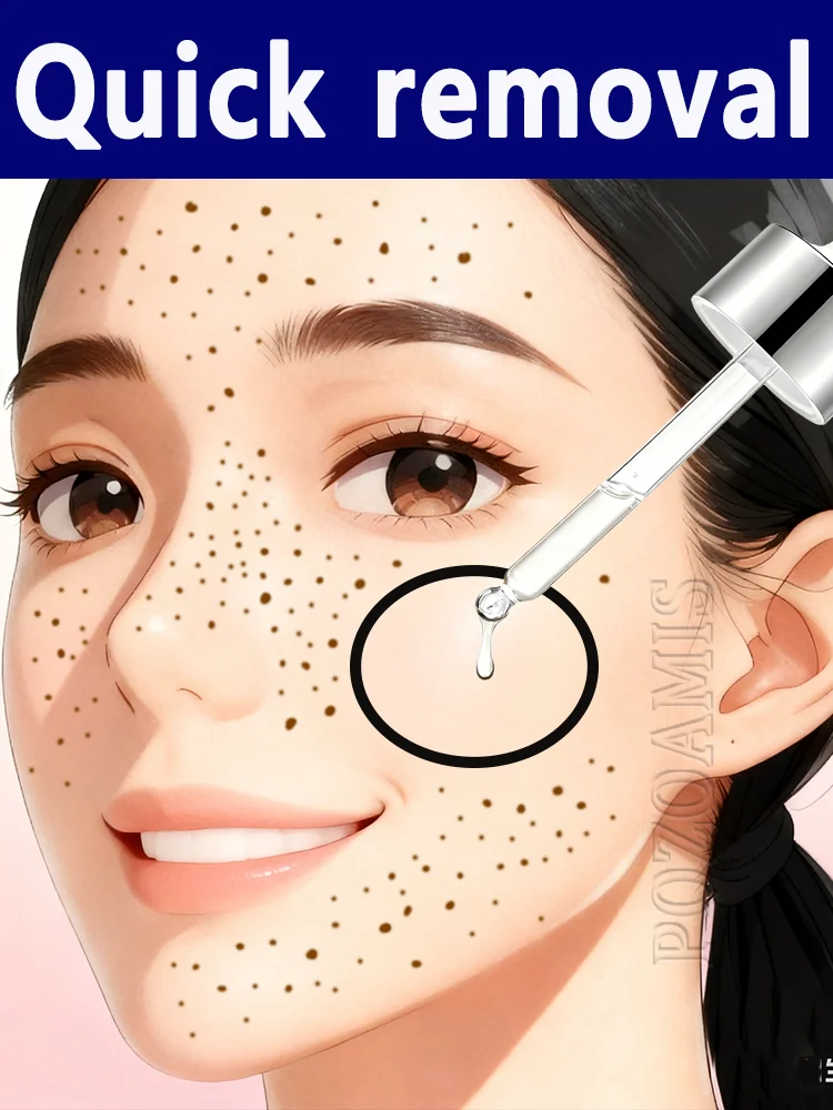 

Из карманного лица к идеально вареному яйцу, это просто один шаг.