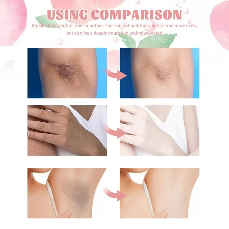 Whitening Cream Underarm Legs Knee Elbow Armpit Bleaching body Lotion Improve Dull Remove Dark Spots Melanin Brighten Skin Care