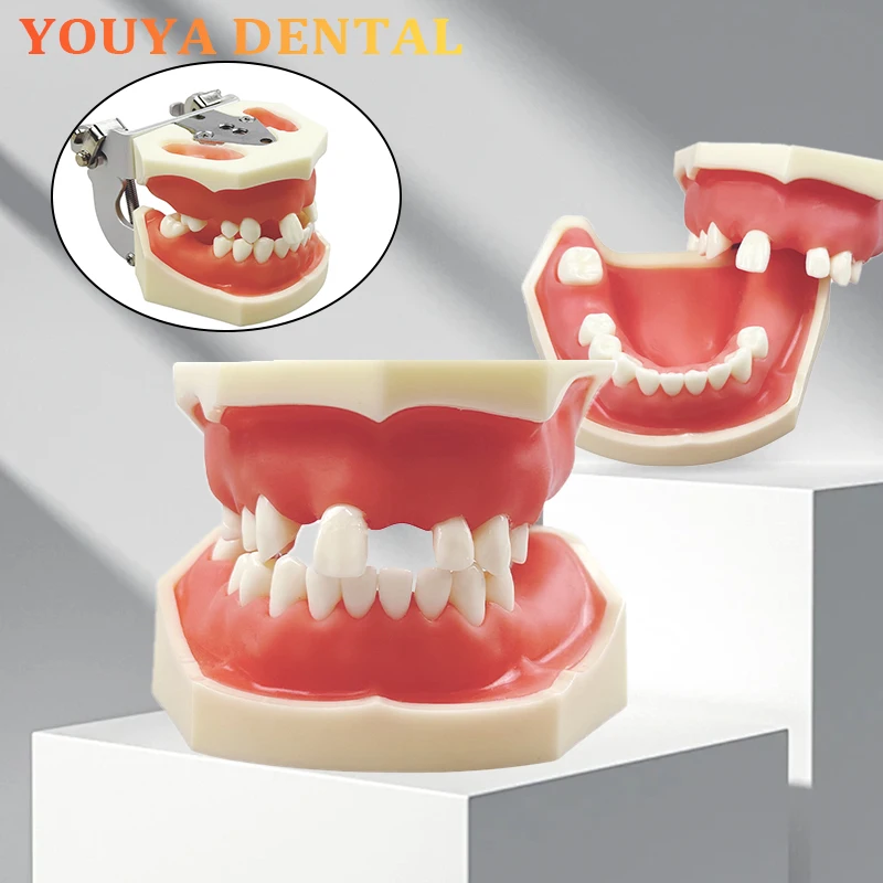 

Dental Upper and Lower Missing Sinus Denture Model Orthodontic Dental Implant Model Teaching Laboratory Demonstration