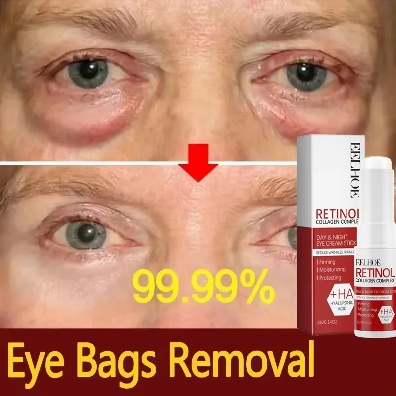 Retinol Eye Cream Collagen Multibalm Stick Reduce Wrinkles Eye Bag Hyaluronic Acid Anti Dark Circle Puffiness Eye Care Products