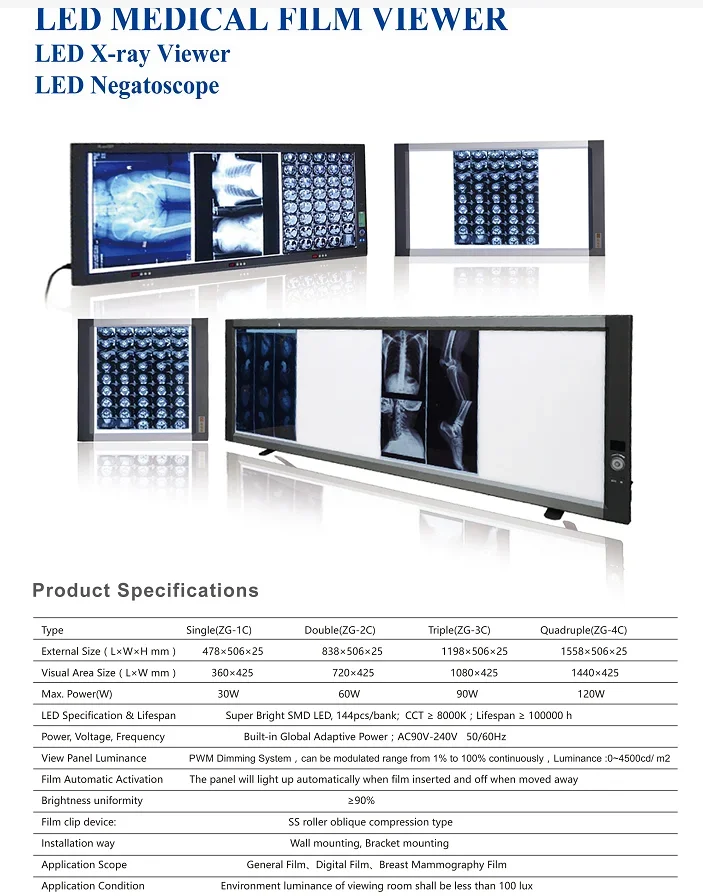 2026/hospital medical X-ray film illuminator, x ray viewing light boxes, x-ray film viewer