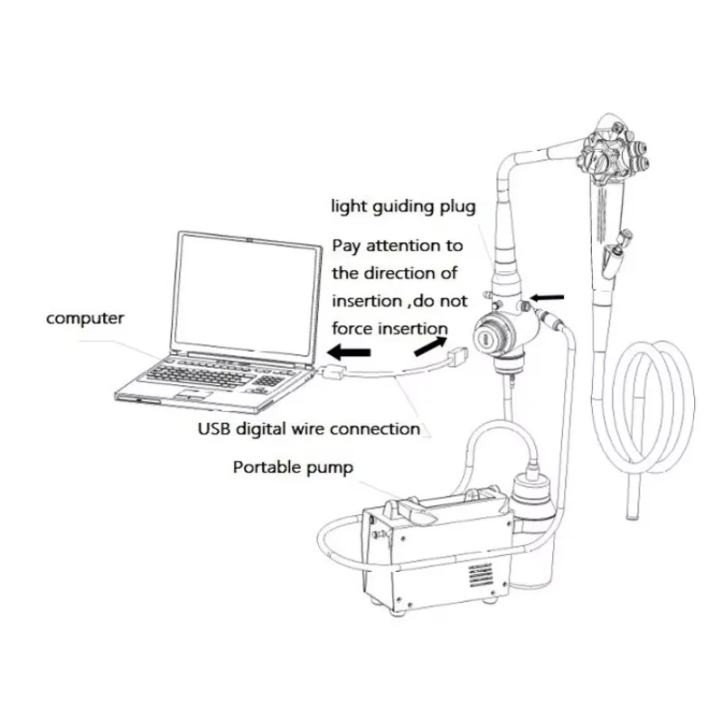 MY-P006C-D Medical Supply Endoscope Usb Flexible Electronic Gastroscope Colonoscope Portable