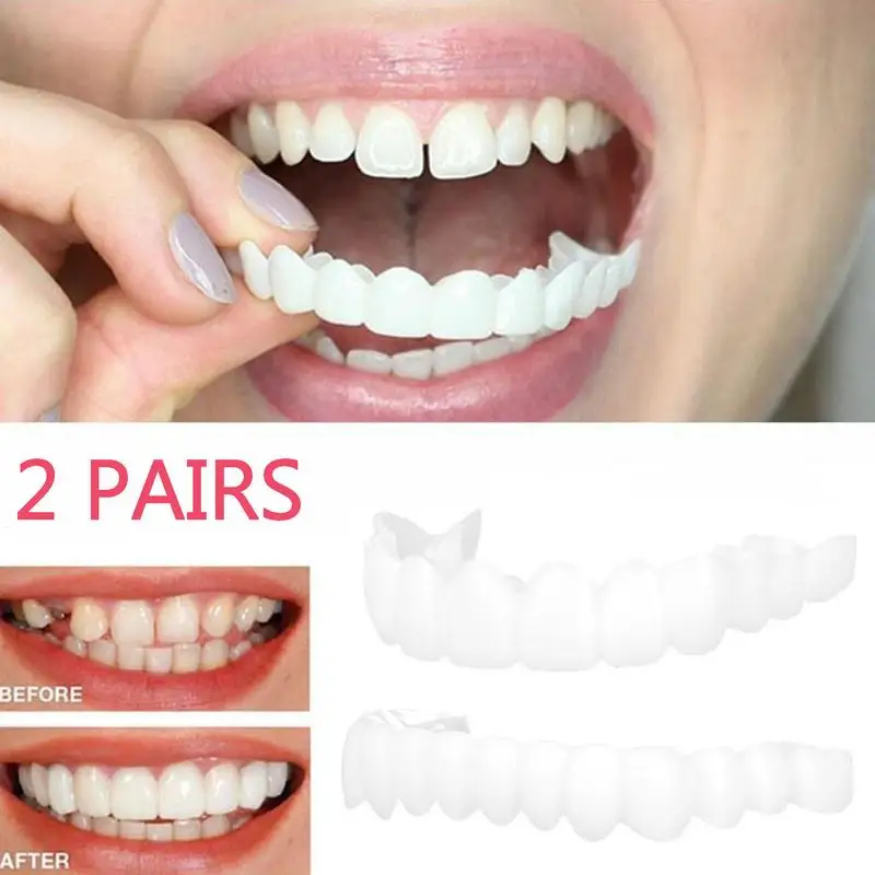 Ferramentas de Higiene Temporária para Mulheres e Homens, Snap On Facetas dos Dentes, Capas para Sorriso Temporário, Confiança Instantânea, Os Dentes Amarelos Danificados, 2 Pares por Conjunto