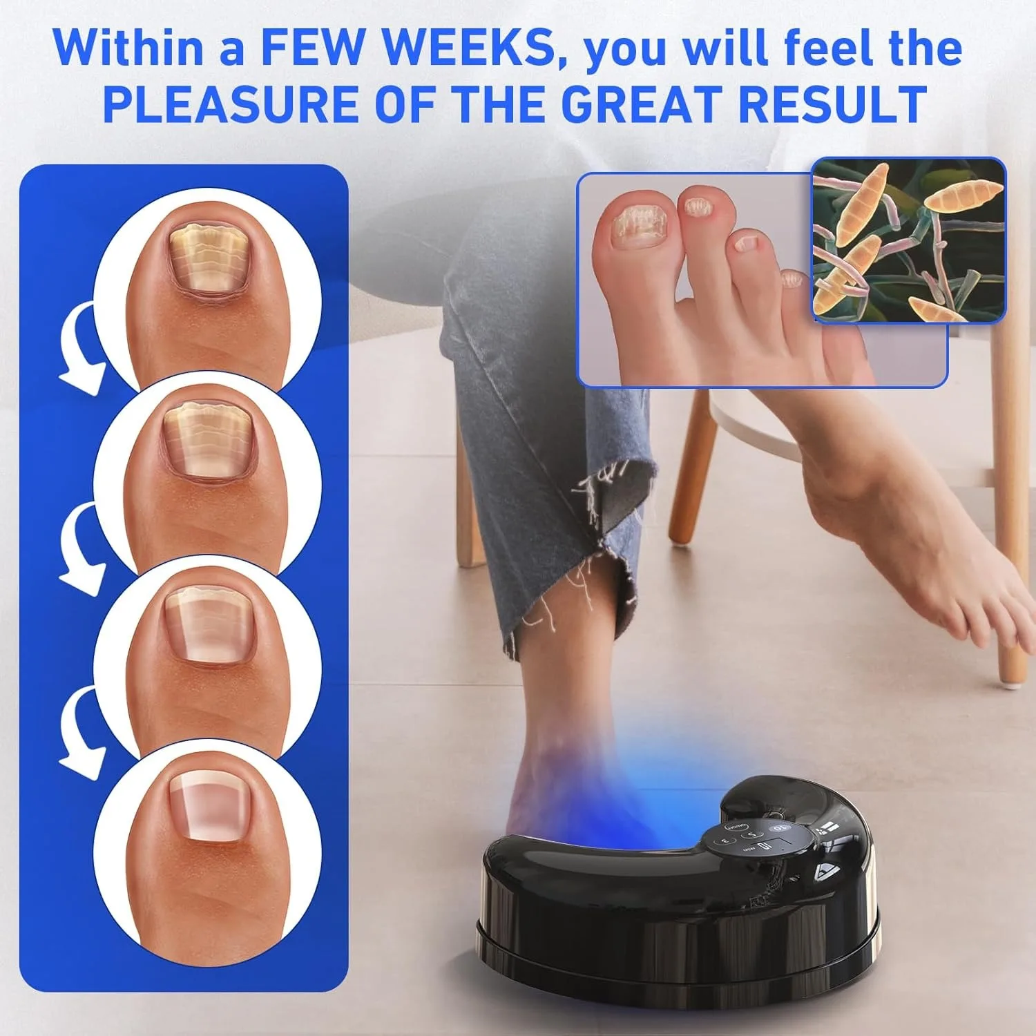 Nail Fungus Laser Device 470nm Blue Light 910nm Infrared Light Hand Foot Toenail for Onychomycosis Anti Fungal Treatment