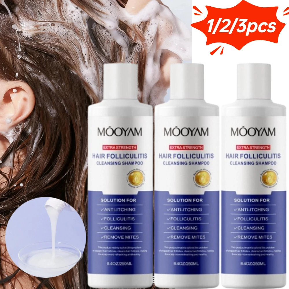 

1/2/3 шт., очищающий шампунь для фолликул, натуральные растения, глубокое очищение кожи головы, зуд, облегчение перхоти, вьющийся освежающий шампунь