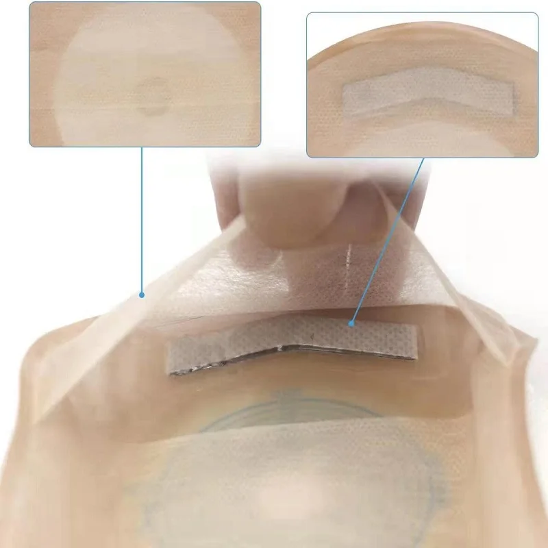 20Pcs One Piece Colostomy Bag Max Cut 70mm Drainable Colostomy Pouch  Supplies for Ileostomy Stoma Care
