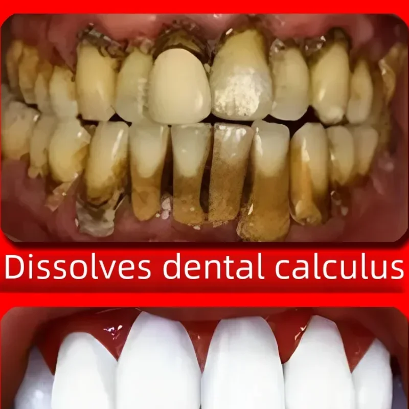 Pasta de dientes amarilla, eliminación de cálculo Dental, olor bucal, prevención del mal aliento, pasta de dientes de fluoruro de Periodontitis