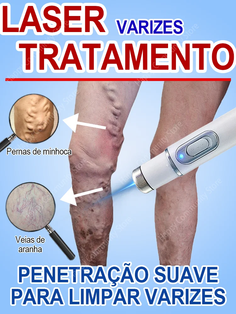 Laser therapy to improve blood circulation
