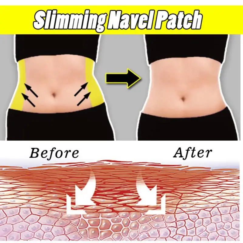1 ~ 10ชิ้นแผ่นแปะลดไขมันหน้าท้องสูตรไม่ระคายเคืองมีประสิทธิภาพและชัดเจนสามารถกำจัดไขมันหน้าท้องใหญ่ได้อย่างรวดเร็ว