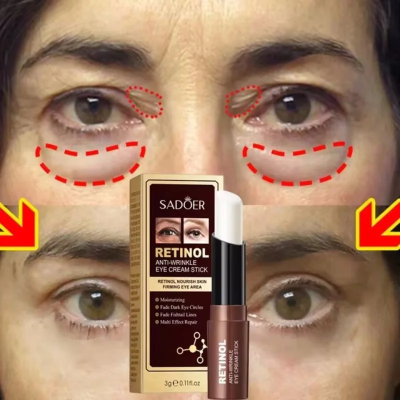 Retinol Eye Cream Removes Dark Circles Eliminates Puffiness Smooths Wrinkles Lifts Eye Muscles Man Woman Eye Care Essence Stick