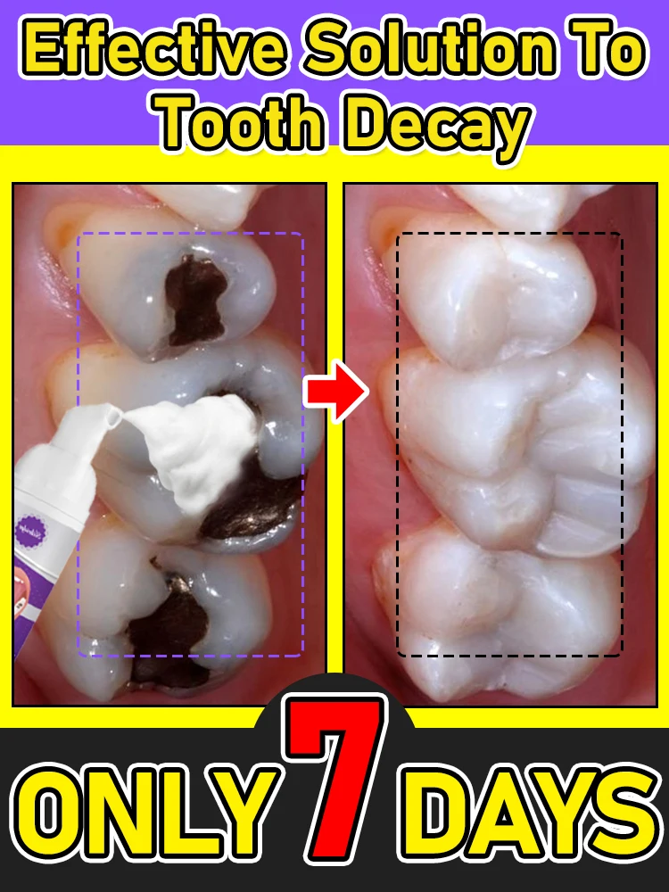 

tooh Decay repair Suitable for all ages
