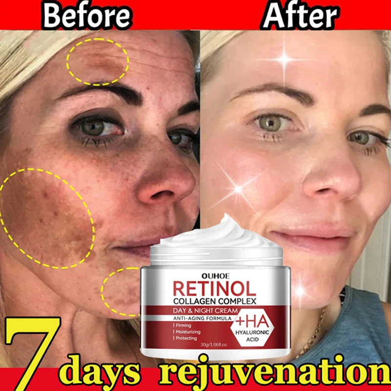 

Retinol Wrinkle Remover Face Cream Firming Lifting Anti Aging Fade Fine Lines Moisturizing Whitening Repair Skin Care Cosmetics