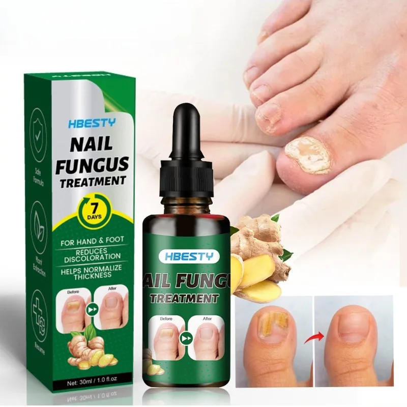 

30ml Nail Fungal Treatment Serum Anti-infective Paronychia Nail Fungus Removal Essential Oil Repairing Cream Care Products