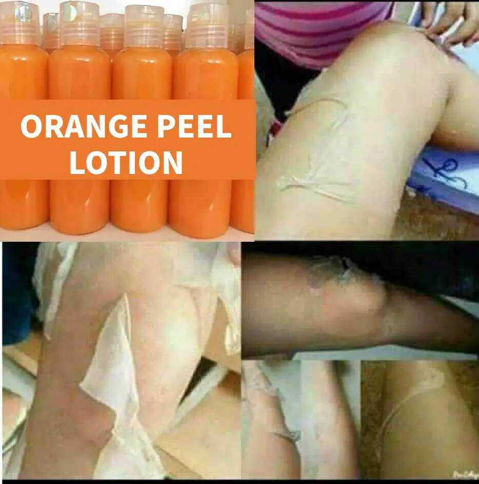 

Orange Peel lotion With Moisturizer Bleaching Face Body Lightening Cream Underarm Whitening Armpit Legs Whitening Cream Knees