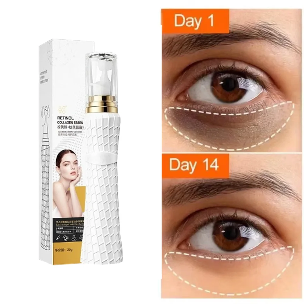 anti-dark-circle-eye-serum-oil-retinol-anti-wrinkle-firming-skin-remove-eye-bag-fade-fine-line-whitening-brighten-eye-care-korea