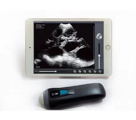 the smallest ultrasound scanner usb ultrasound linear probe