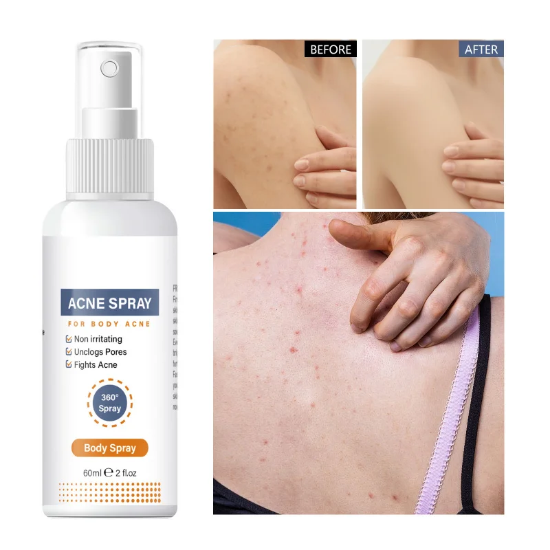 

Отшелушивающая сыворотка Увлажняющая увлажняющая эссенция Отшелушивает, обеспечивает увлажнение и успокаивает сухую плотную кожу