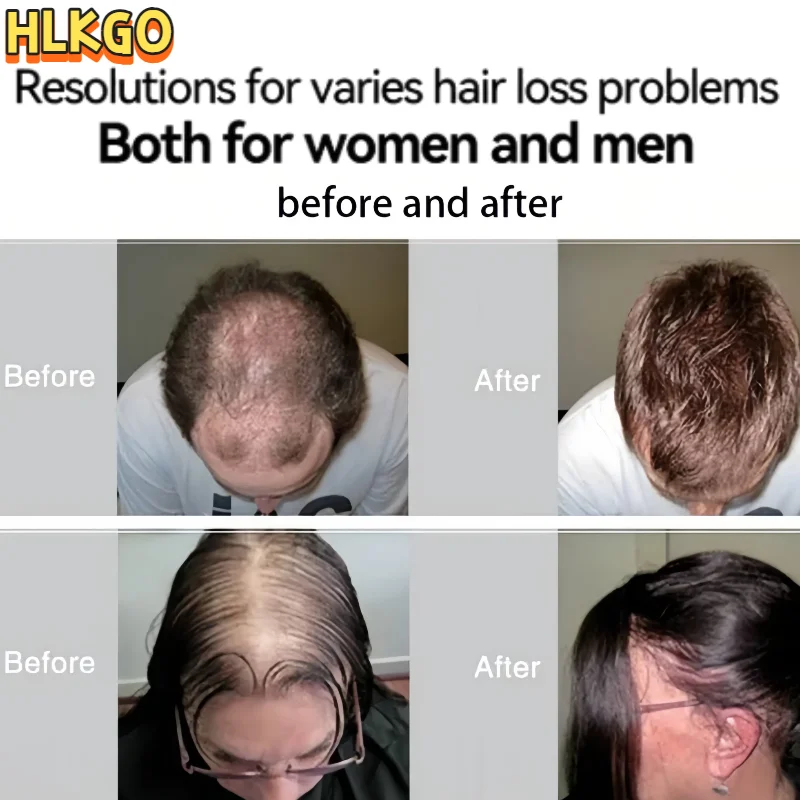 

LLLT Hair Growth Cap for Men & Women Clinical Grade Laser Therapy Hat to Revive Hair Follicles & Reduce Hair Loss