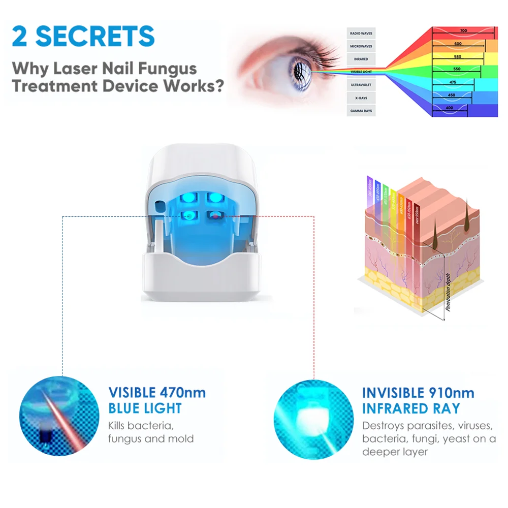 JUSTLANG Rechargeable Fungus Grey Nail Treatment Device Portable Onychomycosis Treatment Laser Therapy Relieve Ingrown Foot Care