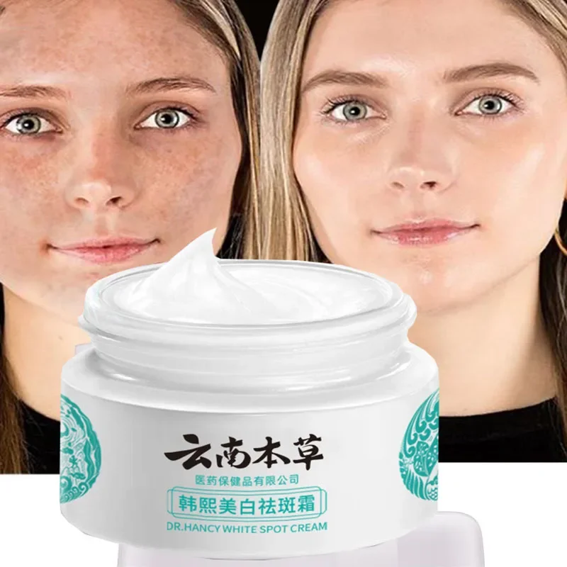 20g Yunnan Herb Powerful Whitening Freckle Cream Remove  Acne Spots Melanin Dark Spots Face Moisturizing Face Skin Care Beauty