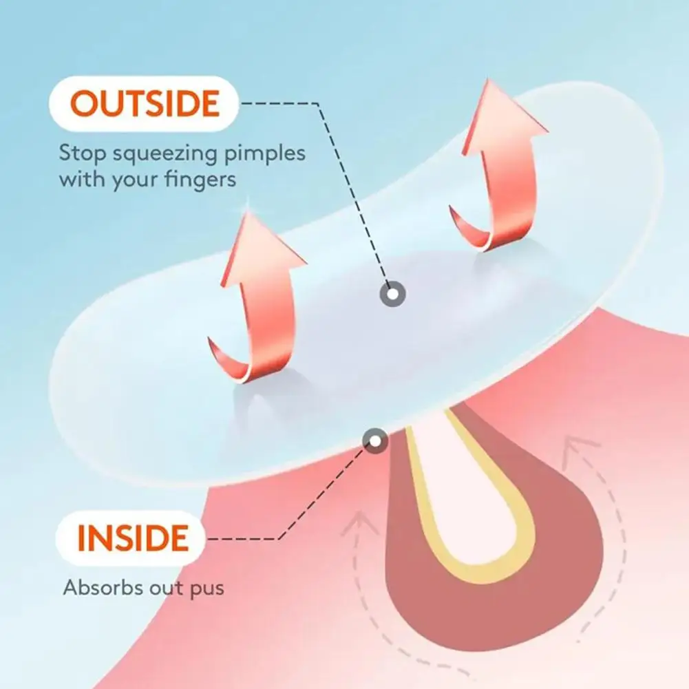 1/3/5 صندوق حب الشباب التصحيح الملونة ستار ماكياج المخفي لصق المياه الغروانية العناية بالبشرة الأرجواني حب الشباب بثرة التصحيح الجلد كشط الجمال