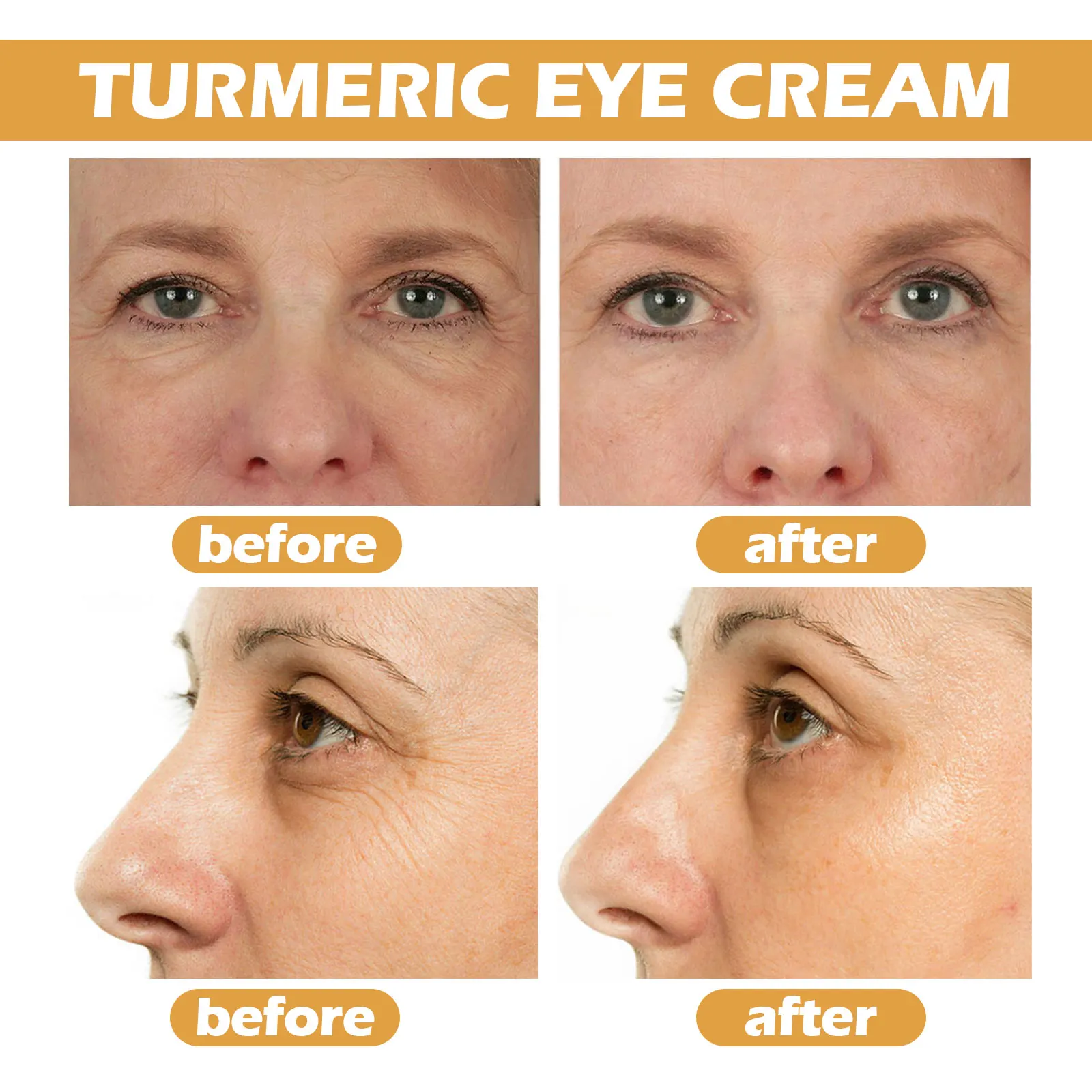 Eelhoe Turmeric Eye Cream Fade Eye Corner Fine Lines and Dark Circles Dark Circle Removal Anti-Wrinkle Brightening Skin Makeup