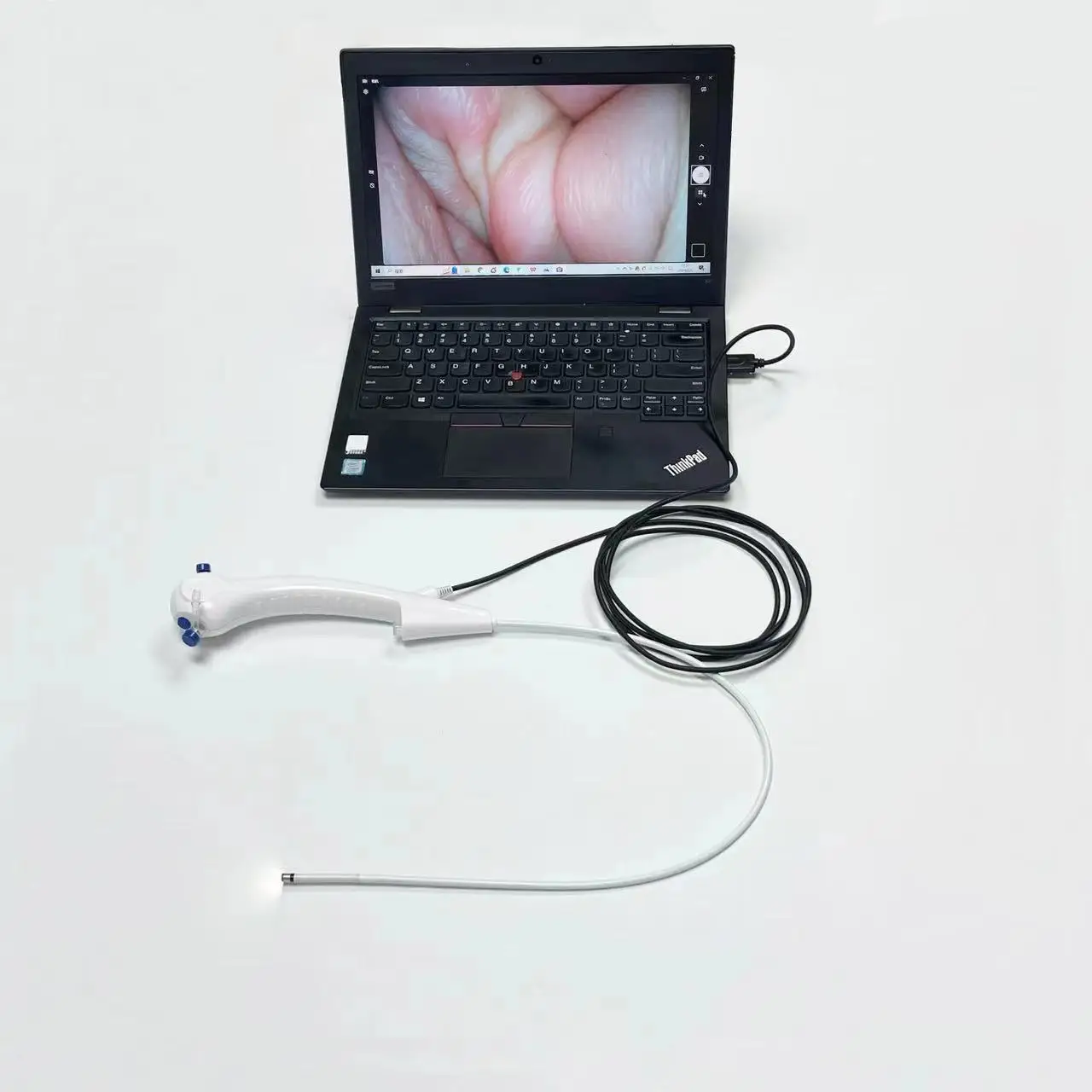 Disposable Flexible Laryngoscope Bronchoscope 3.1mm 3.8mm 5.2mm Endoscope 300/600mm Length USB Link