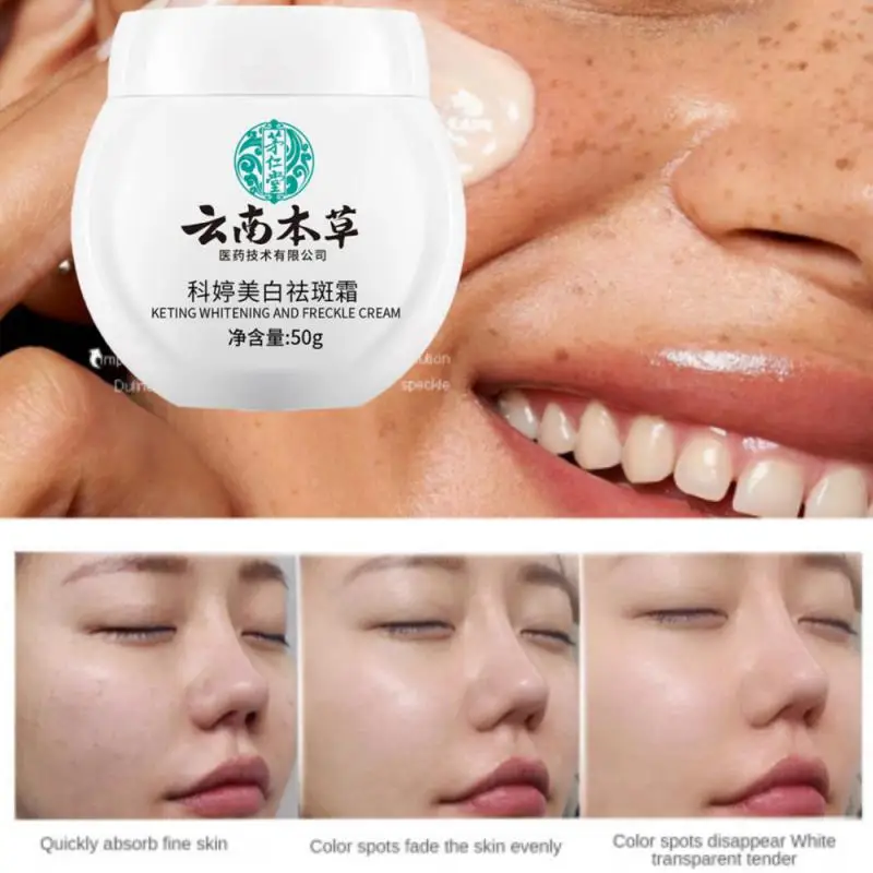 50g Whitening Freckles Cream Remove Melasma Dark Spot Lightening Melasma Moisturize Brighten Removal Face Remover Care Skin