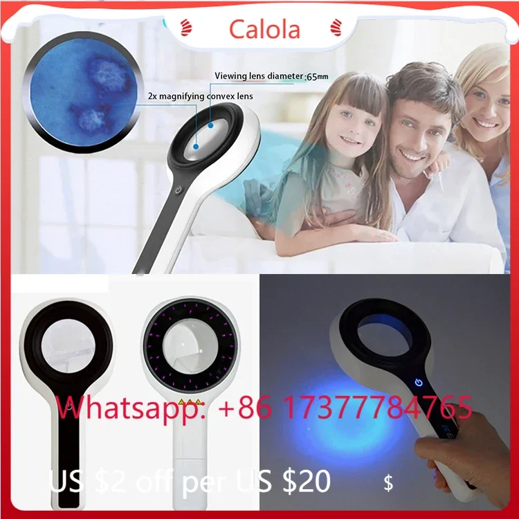 2026 320nm Filtered Ultraviolet  Detect Different Fungal Infection Site Certain Metabolic  Disease Solve Problem