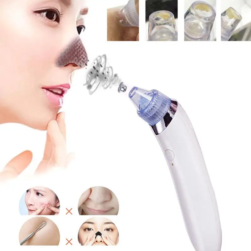 Xn-8030 Powerful Suction Easy To Use High-quality Trending Innovative Must-have Suitable For Sensitive Skin Blackhead Removal