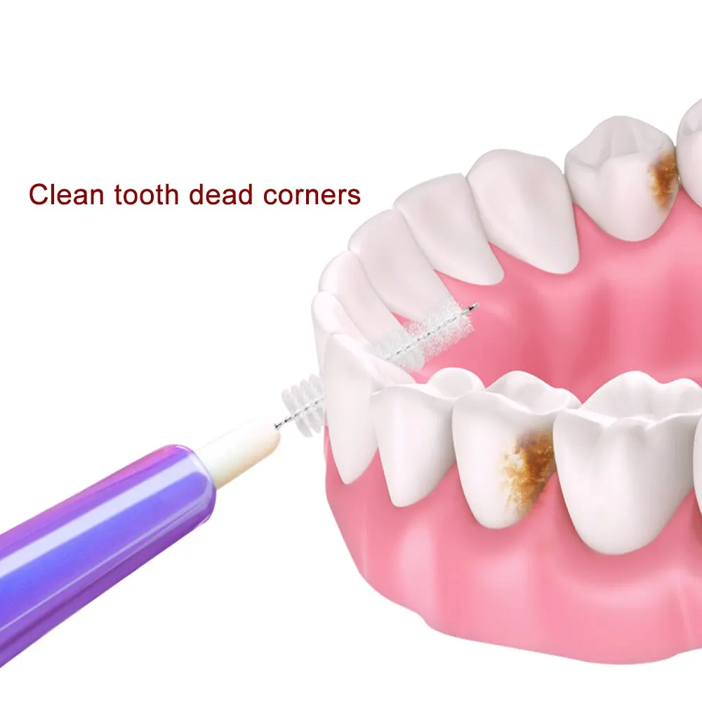 ポータブル歯科用ブラシ,歯のクリーニング,口腔矯正ツール,0.6mm-1.0mm