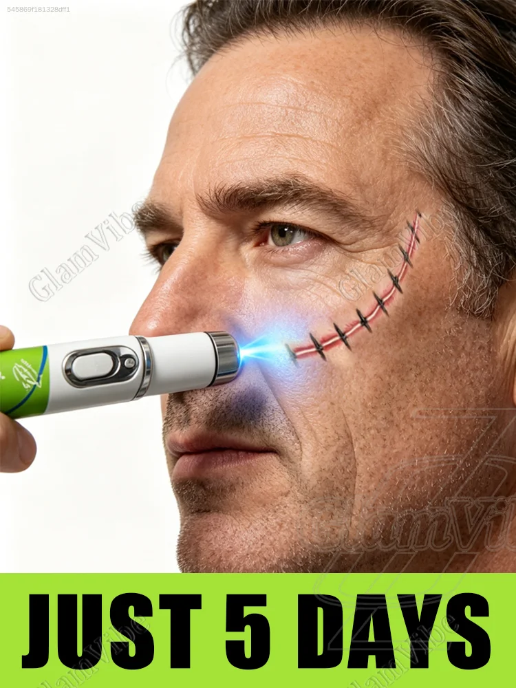 

Fᴀsᴛ Sʜɪᴘᴘɪɴɢ: Wɪʀᴇʟᴇss, Pᴏʀᴛᴀʙʟᴇ Nᴀɴᴏ -Blue Light Repair Pen—Safeguarding Your Skin's Condition Around the Clock.654*/7165489