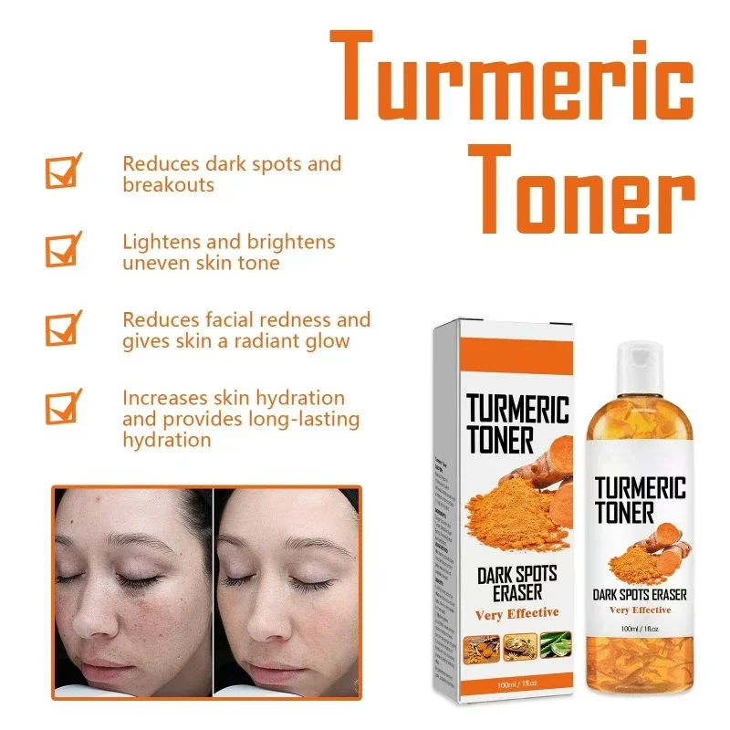 Tóner que ilumina la piel, elimina las pecas, aclara el Melasma, pigmentación, desvanece las manchas oscuras, hidratante, tóner facial de cúrcuma