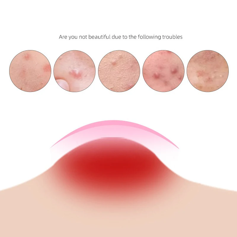 Kleur Cartoon Acne Patch Huidverzorging Sticker Concealer Facial Spot Beauty Makeup Tool