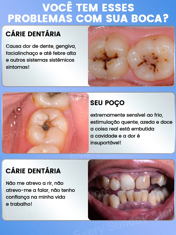 Producto vendedor caliente, el 99% de los compradores compran de nuevo, los dientes son mejor