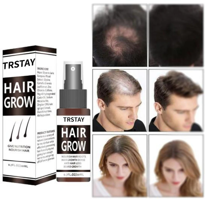 

Новинка, имбирное масло для роста волос, эссенция, спрей для восстановления роста, хлеб, сыворотка с маслом для мужчин и женщин, против выпадения волос, предотвращение облысения