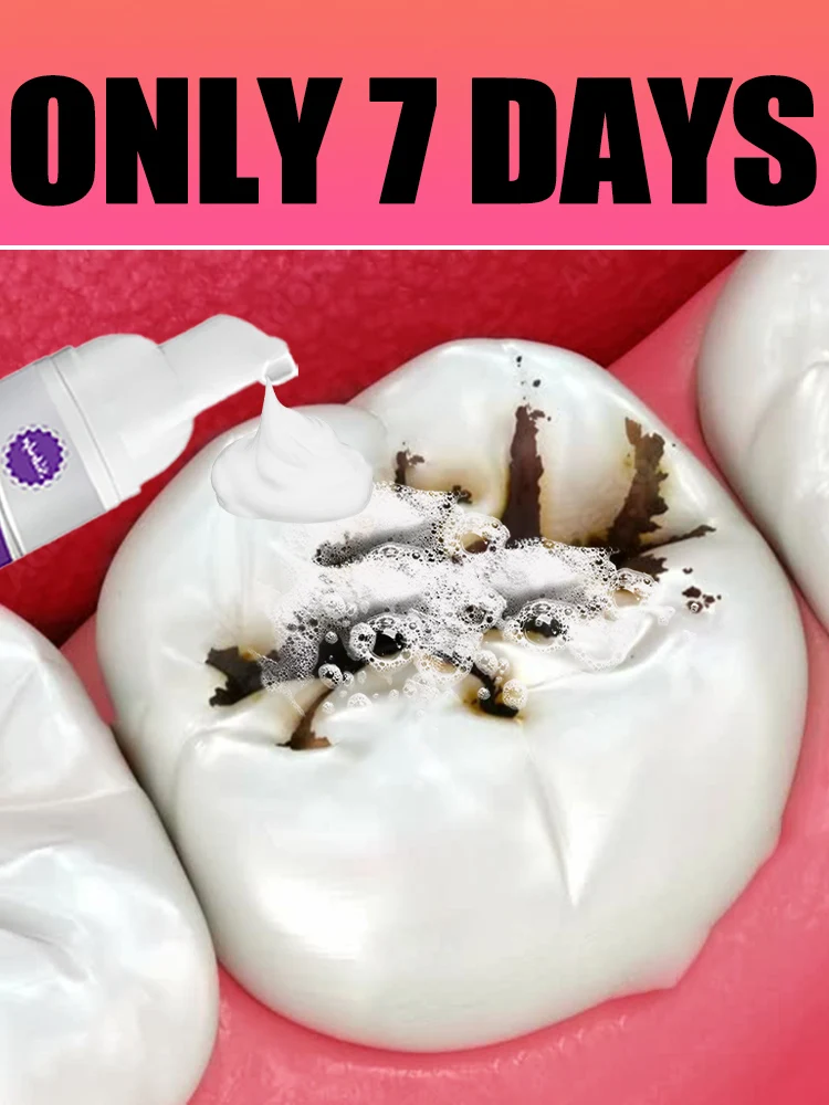 

Generation-2 Set clean Tools Can be purchased individually or More discounts on packages