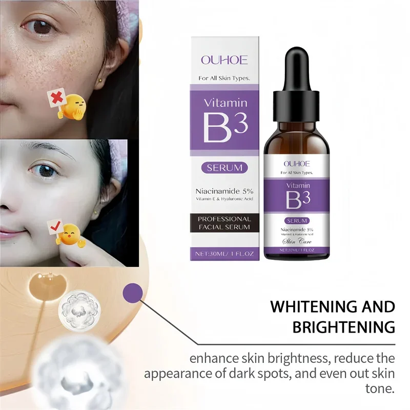

Vitamin B3 Facial Serum Niacinamide 5% Vitanin E Hyakuronic Acid Remove Black Spots Freckle Fade Melanin Pigmentation Brighten