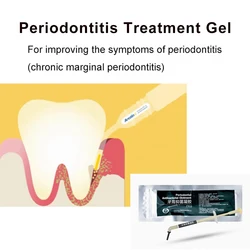 Dental Materials Periodontal Disease Treatment Gel Periodontitis Gum Gingivitis Treatment Paste Perio Gel Dentistry Supplies