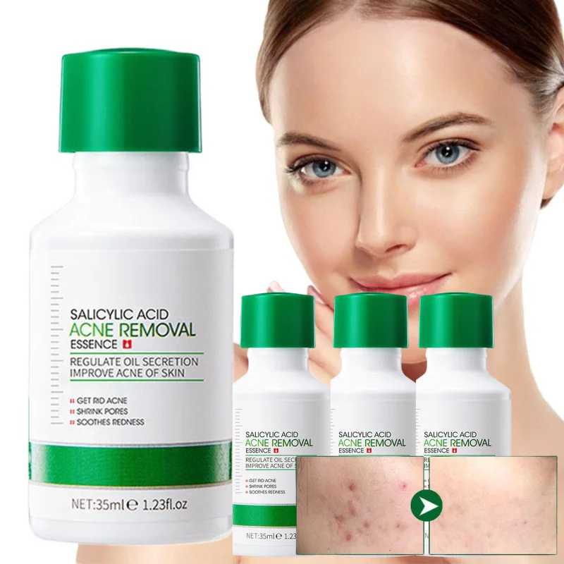 Salicylic Facial Serum Control Oil Serum Smoothing Glow Boosting Stem  Pore Minimizing Cell Ampoule Essence Korean Skin Care