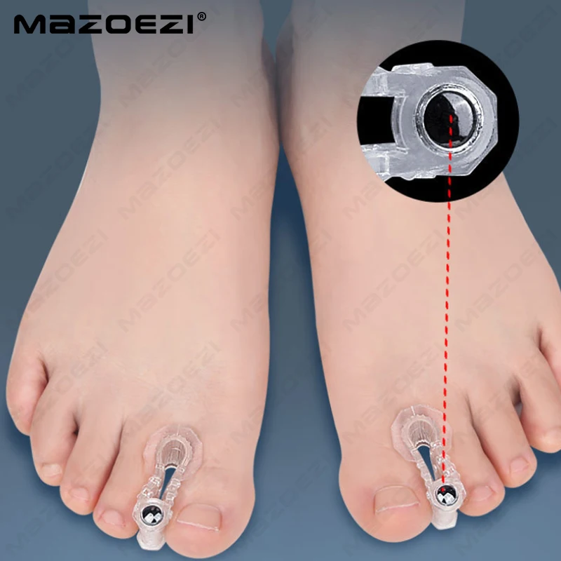 Magnet Orthopädische Big Toe Straightener Hallux Valgus Bunion Corrector Orthesen Füße Knochen Daumen Teller Korrektur Pediküre