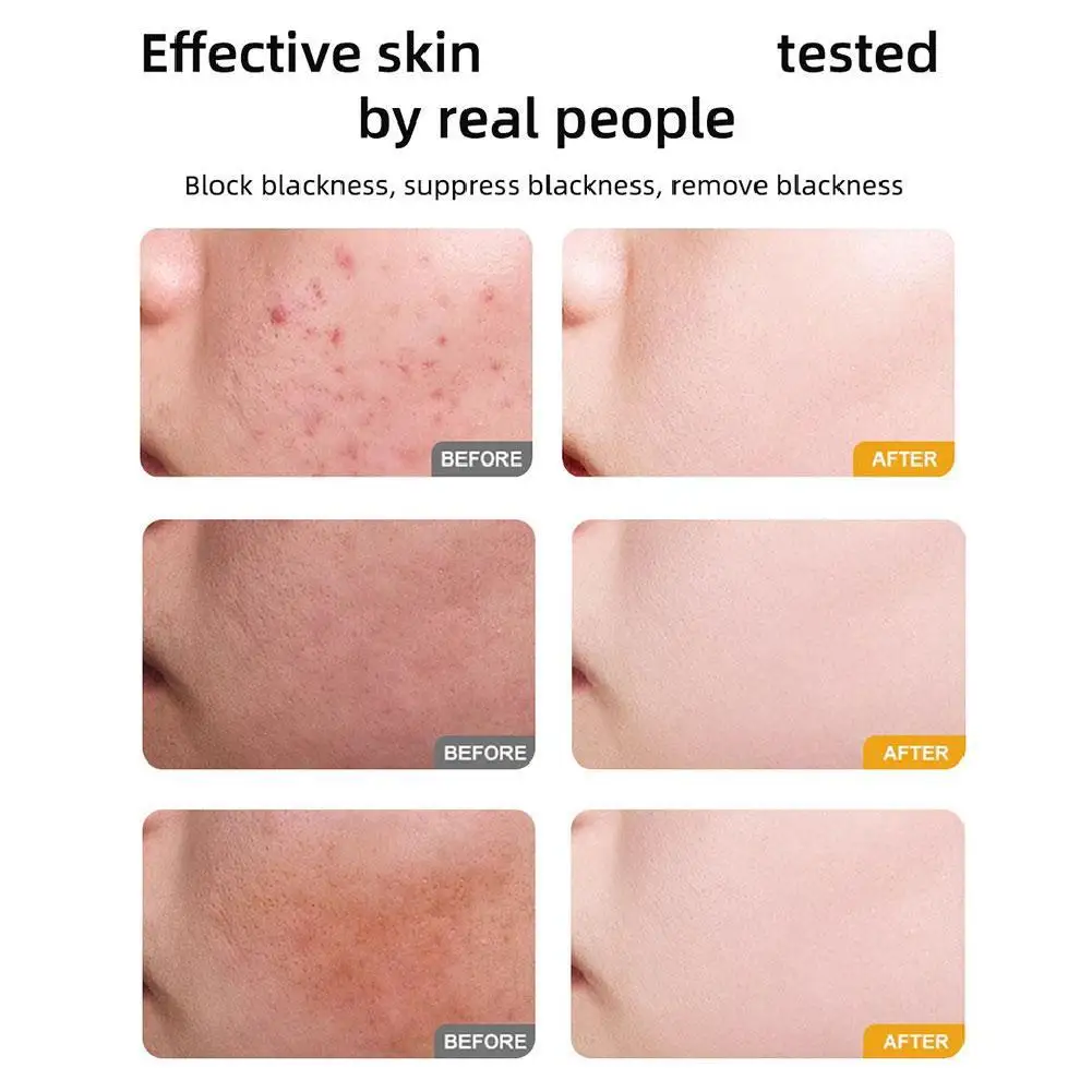 Pamplemousse NIACIN éclaircissant ensemble de soins de la peau nettoyant pour le visage crème pour le visage sérum Toner hydratant en profondeur soin du visage hydratant